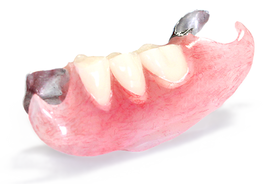 入れ歯補償付き